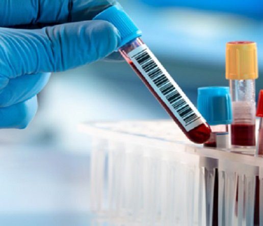 Come prepararsi a un prelievo del sangue