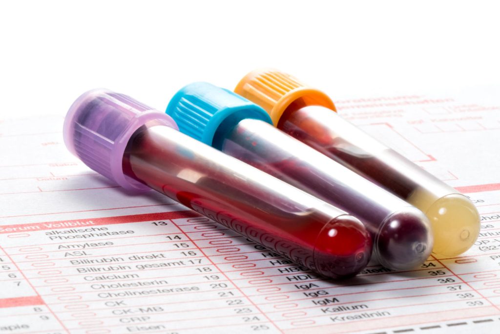 preparasi a un prelievo e agli esami del sangue e delle urine a correggio